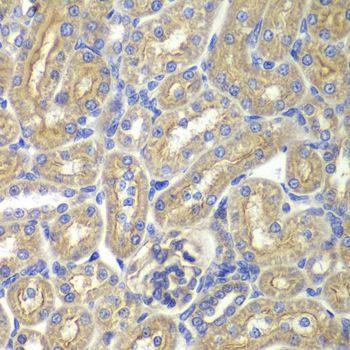 Immunohistochemistry - BAIAP2 antibody (144-05337)