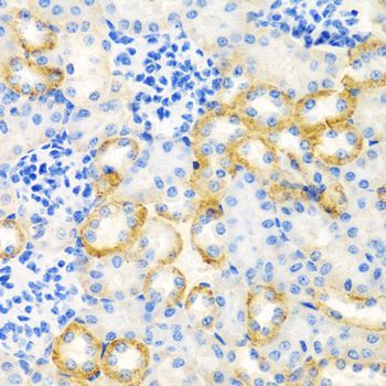 Immunohistochemistry - STC1 antibody (144-06755)