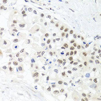 Immunohistochemistry - TRMT1 antibody (144-07116)