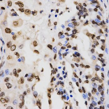 Immunohistochemistry - TriMethyl-Histone H3-K9 antibody (144-02360)