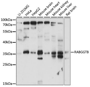 Western blot - RABGGTB antibody (144-015310)