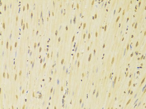 Immunohistochemistry - HNRNPK Antibody (144-01701)
