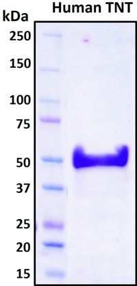SDS-PAGE