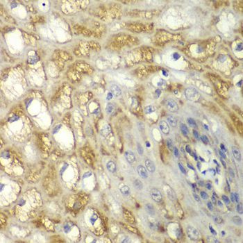 Immunohistochemistry - MYO1C Polyclonal Antibody (144-06936)