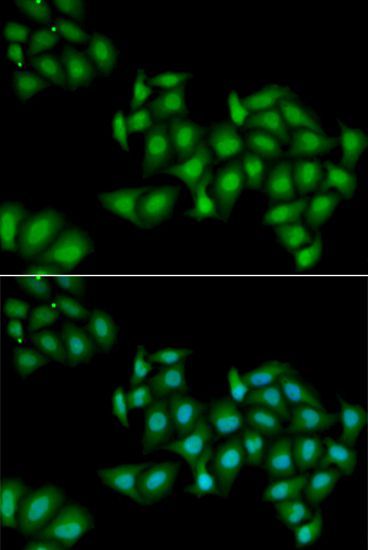Immunofluorescence - DDX1 Polyclonal Antibody (144-06575)