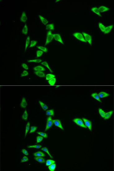 Immunofluorescence - AK1 Polyclonal Antibody (144-01218)