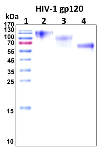 SDS-PAGE Image