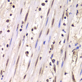 Western blot - LSM4 Polyclonal Antibody (144-05891)
