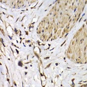 Immunohistochemistry - ISG15 Antibody (144-01182)