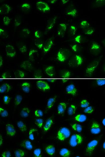 Immunofluorescence - SHMT2 Polyclonal Antibody (144-01215)
