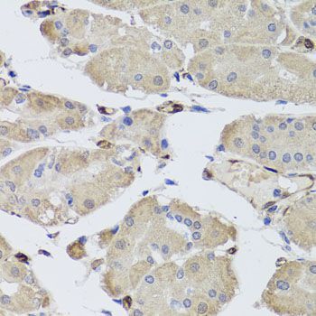 Immunohistochemistry - FABP5 Polyclonal Antibody (144-00947)