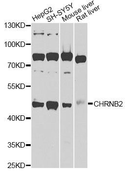 Western blot - CHRNB2 Polyclonal Antibody (144-09808)