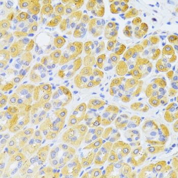 Immunohistochemistry - FAS Polyclonal Antibody (144-00233)