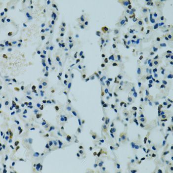 Immunohistochemistry - AHR antibody (144-01451)