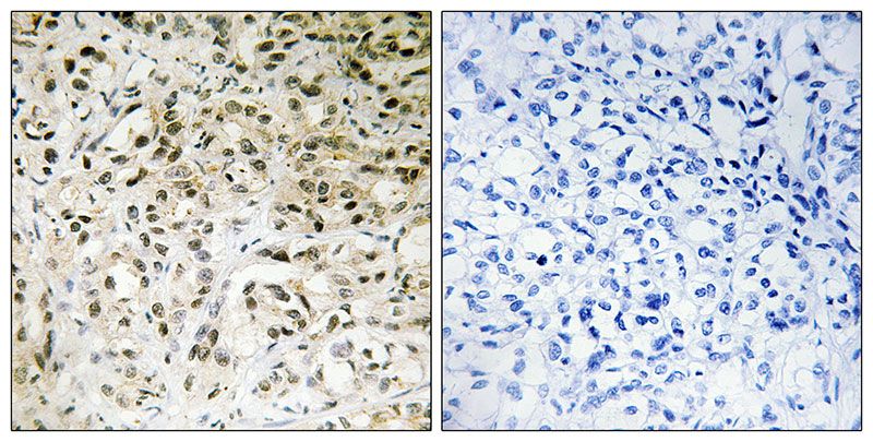 IHC