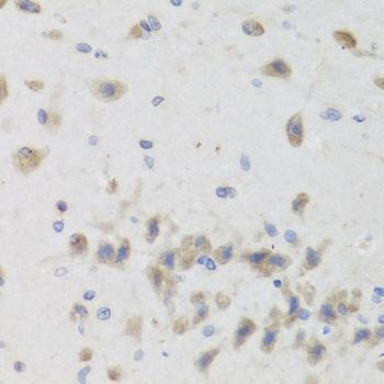 Immunohistochemistry - ISG15 Antibody (144-01182)