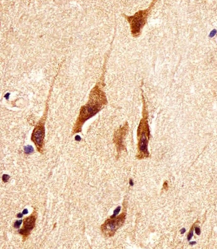 IHC-P
