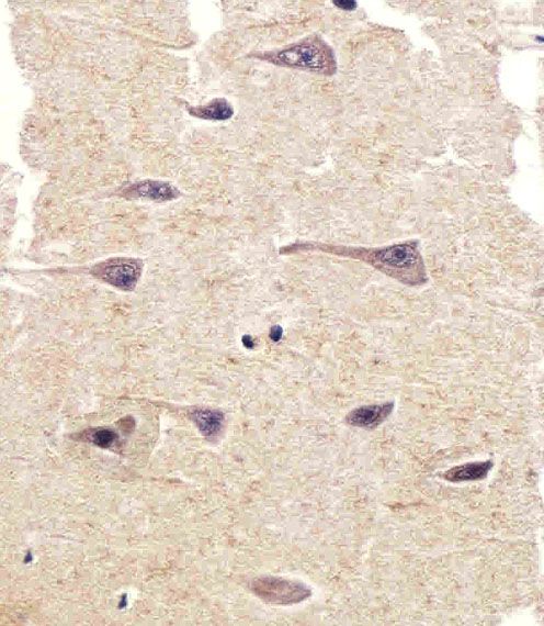 IHC-P