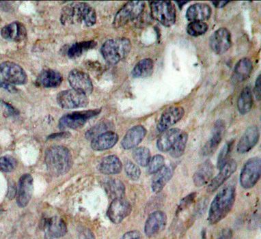 Immunohistochemistry - Phospho-SRC-Y529 antibody (144-61493)