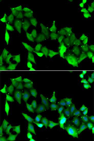 Immunofluorescence - GRK6 Polyclonal Antibody (144-06379)