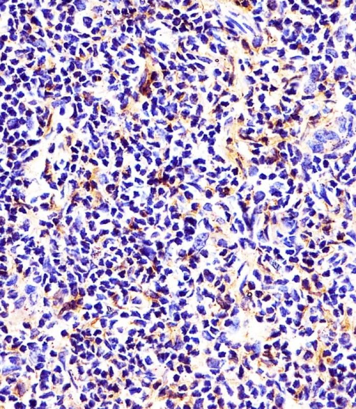 IHC-P