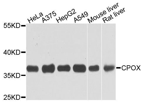 Western blot - CPOX antibody (144-03807)