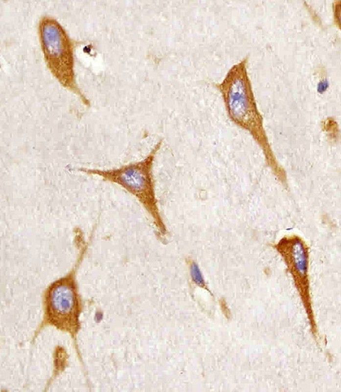 IHC-P