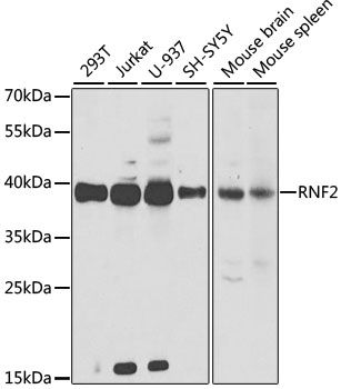 Western blot - RNF2 Polyclonal Antibody (144-05563)