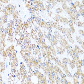 Immunohistochemistry - [KO Validated] CHD1 Polyclonal Antibody (144-07883)