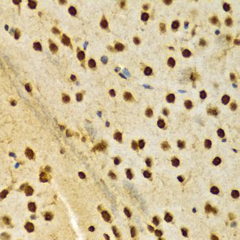 Immunohistochemistry - [KO Validated] HNRNPA2B1 Polyclonal Antibody (144-01162)