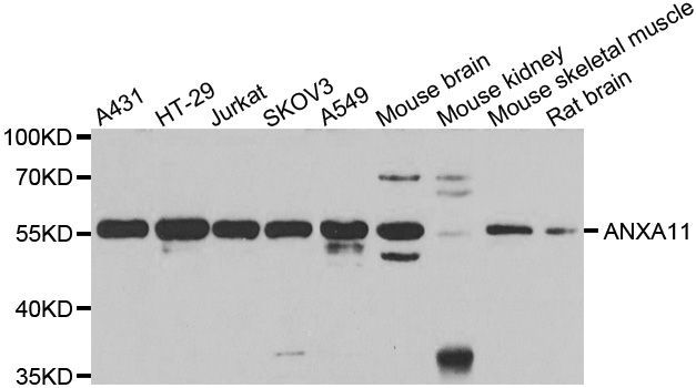 Western blot - ANXA11 Polyclonal Antibody (144-07423)