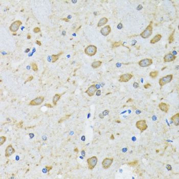 Immunohistochemistry - ATG7 Polyclonal Antibody (144-00691)