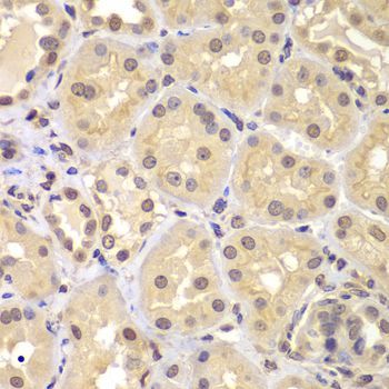 Immunohistochemistry - KPNA6 antibody (144-07363)