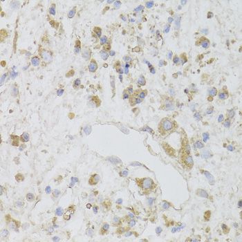 Immunohistochemistry - CIAPIN1 Polyclonal Antibody (144-06336)