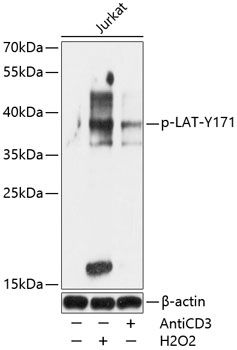 Western blot