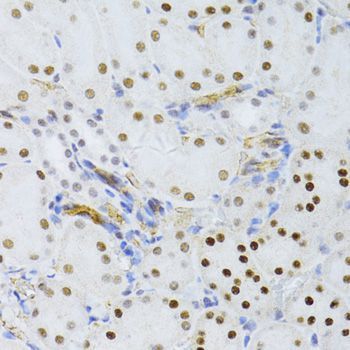 Immunohistochemistry - SNRNP70 antibody (144-06065)