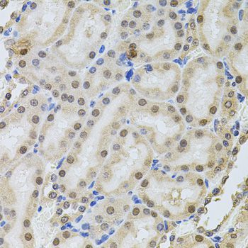 Immunohistochemistry - POP4 antibody (144-04452)