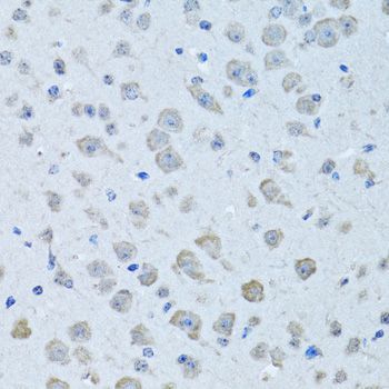 Immunohistochemistry - KNG1 antibody (144-013919)