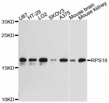 Western blot - RPS18 antibody (144-011687)