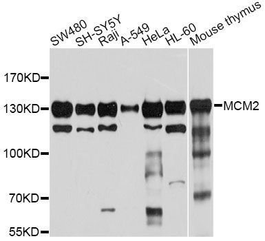 Western blot - MCM2 Polyclonal Antibody (144-01056)