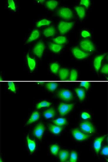 Immunofluorescence - RPS5 Polyclonal Antibody (144-06975)