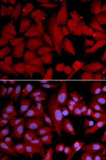 Western blot - PSMA4 Polyclonal Antibody (144-02511)