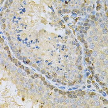 Immunohistochemistry - BUB1 Antibody (144-01929)