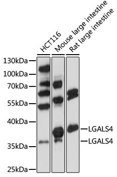 Western blot