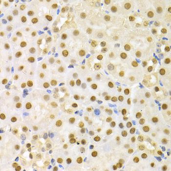 Immunohistochemistry - SFN Polyclonal Antibody (144-01026)