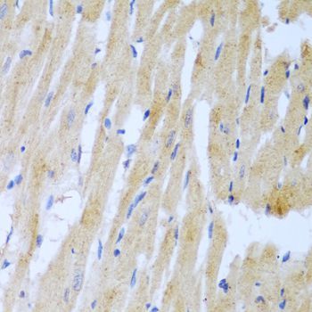 Immunohistochemistry - UBE2L3 Polyclonal Antibody (144-04175)