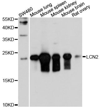 Western blot - LCN2 Polyclonal Antibody (144-61357)