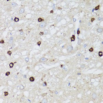 Immunohistochemistry - MIP antibody (144-02886)