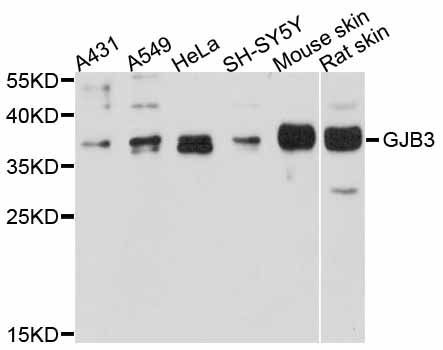 Western blot - GJB3 Polyclonal Antibody (144-02949)