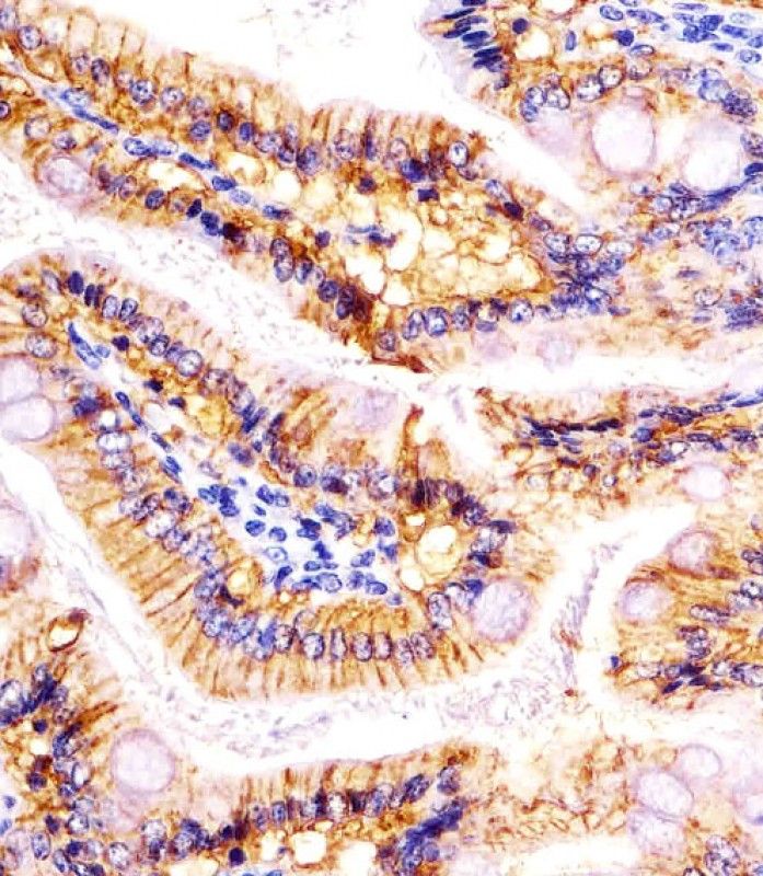 IHC-P
